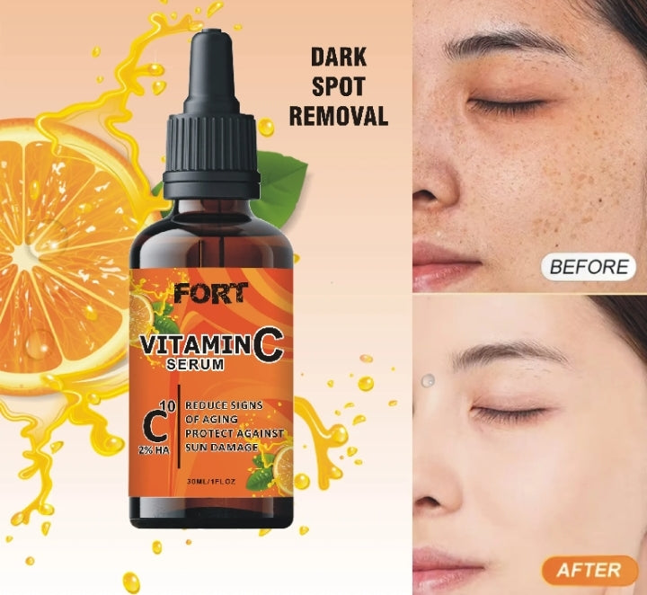 FORT Vitamin C Serum – Dark Spots, Acne Marks & Skin Brightening