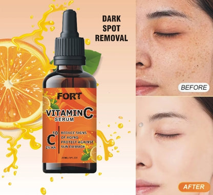 FORT Vitamin C Serum – Dark Spots, Acne Marks & Skin Brightening