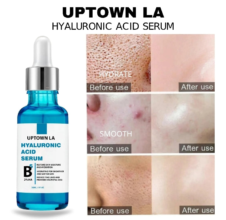 UPTOWN LA Hyaluronic Acid Face Serum – Hydrating & Plumping Formula
