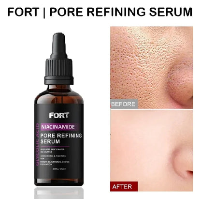 FORT Salicylic Acid Serum – Anti-Acne Face Serum & Dark Spot Correcting Serum for Glowing Skin
